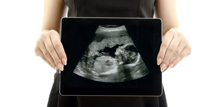 Cover Image of Proses Perkembangan Janin pada Kehamilan Minggu Ke-10