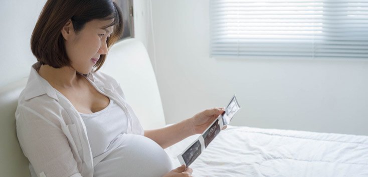 Cover Image of Perkembangan Otak Janin di Tiap Trimester & Nutrisi Pentingnya