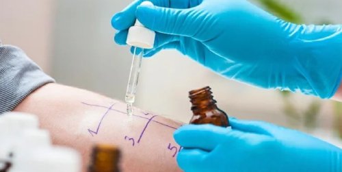 Cover Image of Tes Alergi Bagi Anak