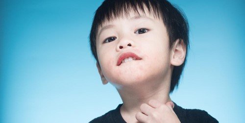 Cover Image of Gejala dan Cara Mengatasi Alergi Makanan pada Anak