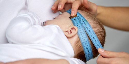 Cover Image of Benarkah Semakin Besar Kepala Bayi Berarti Semakin Pintar? Simak Penjelasannya!