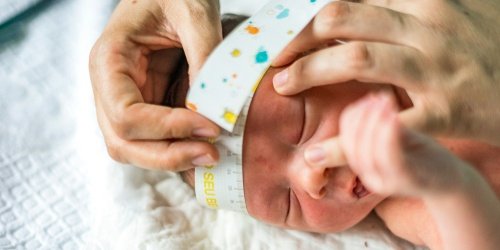 Cover Image of Seperti Apa Ukuran dan Bentuk Kepala Bayi Normal?