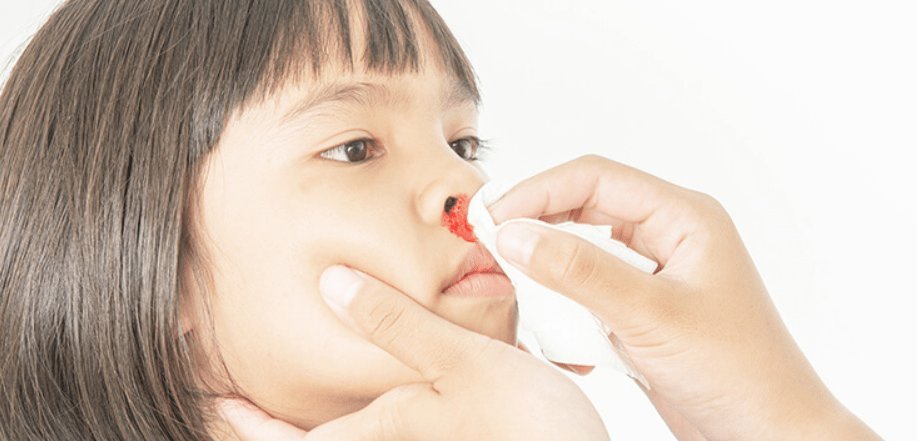 Cover Image of Kenali Penyebab Mimisan pada Anak dan Cara Mengatasinya