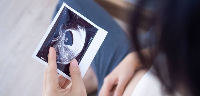 Cover Image of Perkembangan Janin 30 Minggu dan Tips Jelang Persalinan